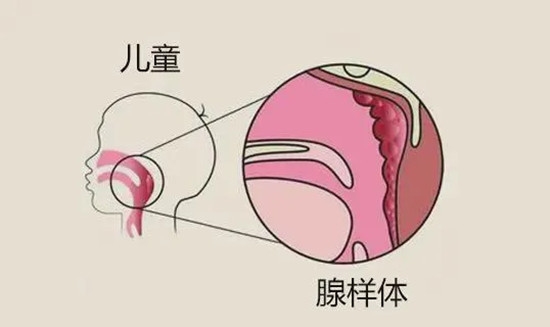 640 (1)_副本 640 (1)_副本
