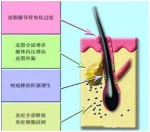 640 (1)_副本 640 (1)_副本