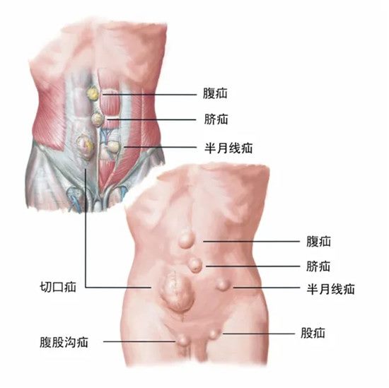 640 (1)_副本 640 (1)_副本