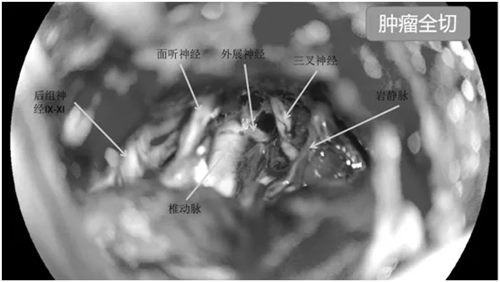 640 (4)_副本