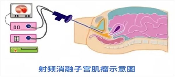 640_副本 640_副本