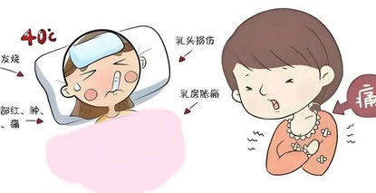 新手媽媽的“甜蜜負(fù)擔(dān)”-- 哺乳期乳腺炎